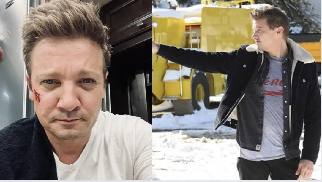 Jeremy Renner Shares Photo Of Injuries After Snow Plow Accident