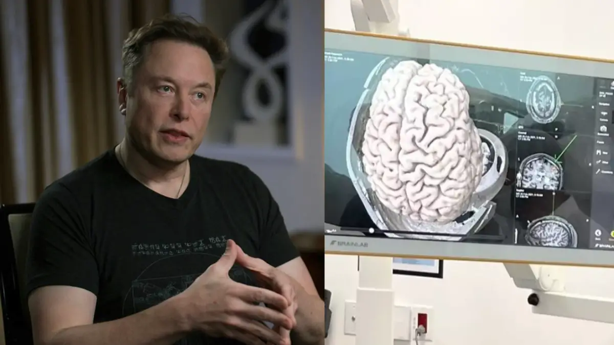 Elon Musk Says First Neuralink Brain Chip has been Implanted in a Human
