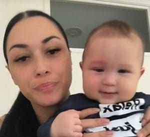 Internet Criticizes Mother For Removing Baby’s Birthmark With Laser Treatment