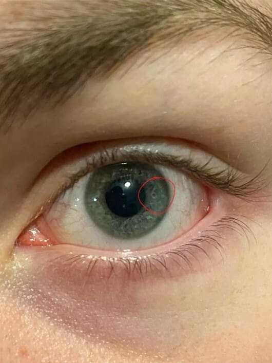 Woman Thinks Her Boyfriend Is ‘Factory Made’ After Noticing Weird Detail In His Eye