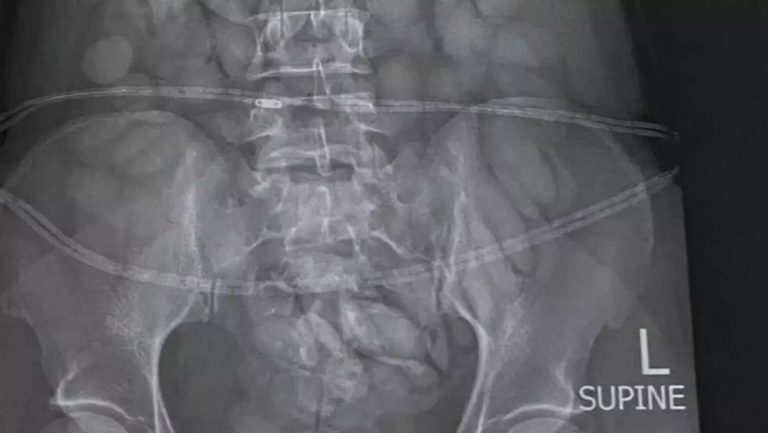 Airport Security Arrests Woman After One Glance At Her X-Ray