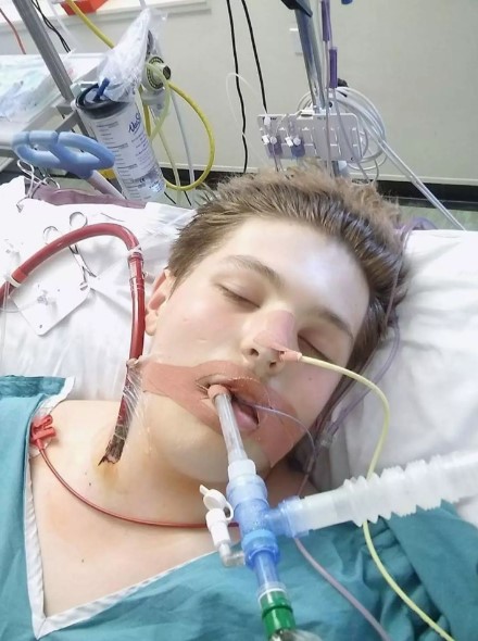 Dire Warning Issued Over Vaping After 16-Year-Old Put On Life Support