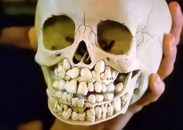 People Shocked To See What A Child’s Skull Looks Like